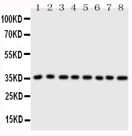 WB analysis of various samples using GTX11808 Annexin III antibody. Lane 1 : rat brain tissue lysate at 50ug Lane 2 : rat testis tissue lysate at 50ug Lane 3 : rat skeletal muscle tissue lysate at 50ug Lane 4 : rat lung tissue lysate at 50ug Lane 5 : SW620 whole cell lysate at 40ug Lane 6 : HeLa whole cell lysate at 40ug Lane 7 : SMMC whole cell lysate at 40ug Lane 8 : MCF-7 whole cell lysate at 40ug Dilution : 0.5 microg/mL