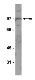 WB analysis of 3T3/A31 cell lysate using GTX11810 Kaiso antibody [2T15].<br>Dilution : 2?g/ml
