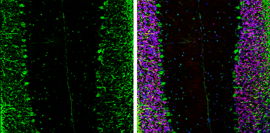 EIF4G3 antibody [N1], N-term detects EIF4G3 protein expression by immunohistochemical analysis. Sample: Frozen-sectioned adult mouse cerebellum. Green: EIF4G3 protein stained by EIF4G3 antibody [N1], N-term (GTX118109) diluted at 1:250. Red: NeuN, stained by NeuN antibody [2Q158] (GTX30773) diluted at 1:500. Blue: Fluoroshield with DAPI (GTX30920).