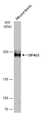 Mouse tissue extract (50 μg) was separated by 5% SDS-PAGE, and the membrane was blotted with EIF4G3 antibody [N1], N-term (GTX118109) diluted at 1:1000. The HRP-conjugated anti-rabbit IgG antibody (GTX213110-01) was used to detect the primary antibody.