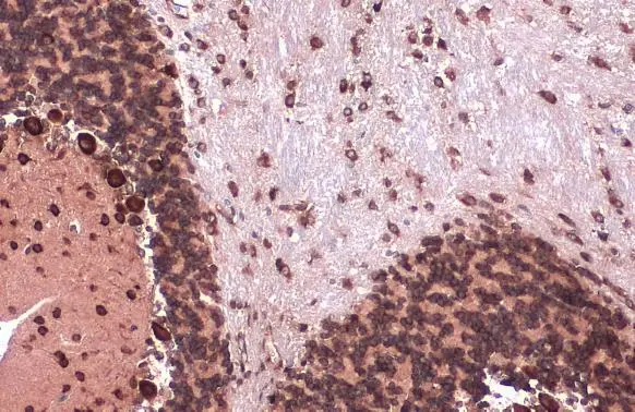 EIF4G3 antibody [N1], N-term detects EIF4G3 protein at cytoplasm by immunohistochemical analysis. Sample: Paraffin-embedded mouse brain. EIF4G3 stained by EIF4G3 antibody [N1], N-term (GTX118109) diluted at 1:500. Antigen Retrieval: Citrate buffer, pH 6.0, 15 min