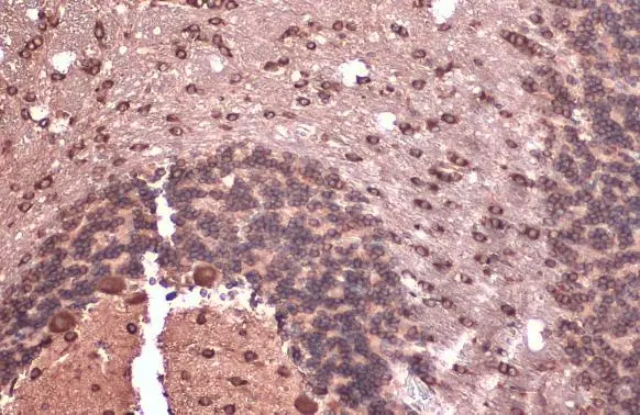EIF4G3 antibody [N1], N-term detects EIF4G3 protein at cytoplasm by immunohistochemical analysis. Sample: Paraffin-embedded rat brain. EIF4G3 stained by EIF4G3 antibody [N1], N-term (GTX118109) diluted at 1:500. Antigen Retrieval: Citrate buffer, pH 6.0, 15 min