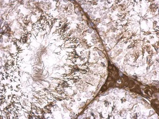 KLHL25 antibody [C1C3] detects KLHL25 protein at cytosol on mouse testis by immunohistochemical analysis. Sample: Paraffin-embedded mouse testis. KLHL25 antibody [C1C3] (GTX118140) dilution: 1:500. 
 Antigen Retrieval: Trilogy? (EDTA based, pH 8.0) buffer, 15min