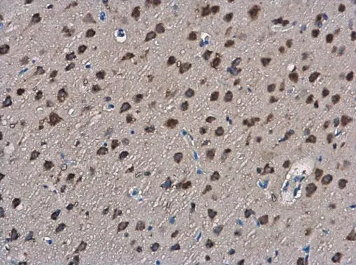 SLIT2 antibody detects SLIT2 protein at cytoplasm in rat brain by immunohistochemical analysis. Sample: Paraffin-embedded rat brain. SLIT2 antibody (GTX118220) diluted at 1:400. 
 Antigen Retrieval: Citrate buffer, pH 6.0, 15 min