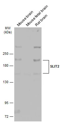 Various tissue extracts (50 μg) were separated by 5% SDS-PAGE, and the membrane was blotted with SLIT2 antibody (GTX118220) diluted at 1:1000. The HRP-conjugated anti-rabbit IgG antibody (GTX213110-01) was used to detect the primary antibody.