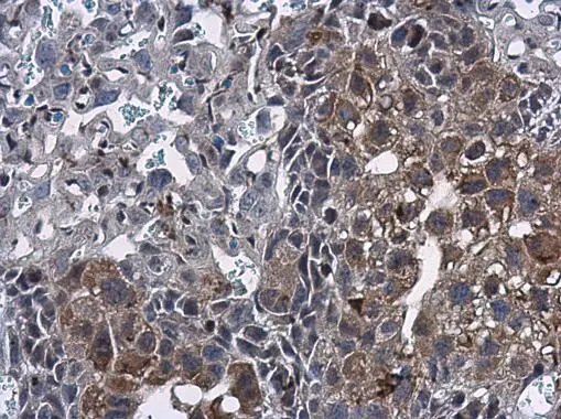 Mig-6 antibody [N1C1] detects Mig-6 protein at cytoplasm in mouse placenta by immunohistochemical analysis. Sample: Paraffin-embedded mouse placenta. Mig-6 antibody [N1C1] (GTX118238) diluted at 1:500. 
 Antigen Retrieval: Citrate buffer, pH 6.0, 15 min