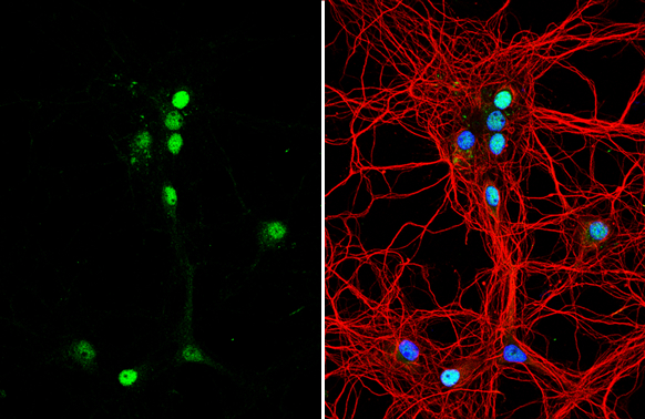 TNR antibody [C1C2], Internal detects TNR protein by immunofluorescent analysis. Sample: DIV9 rat E18 primary hippocampal neuron cells were fixed in 4% paraformaldehyde at RT for 15 min. Green: TNR stained by TNR antibody [C1C2], Internal (GTX118246) diluted at 1:500. Red: beta Tubulin 3/ Tuj1, stained by beta Tubulin 3/ Tuj1 antibody [GT11710] (GTX631836) diluted at 1:500. Blue: Fluoroshield with DAPI (GTX30920).
