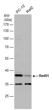 Various whole cell extracts (30 μg) were separated by 10% SDS-PAGE, and the membrane was blotted with Rad51 antibody (GTX118249) diluted at 1:500.
