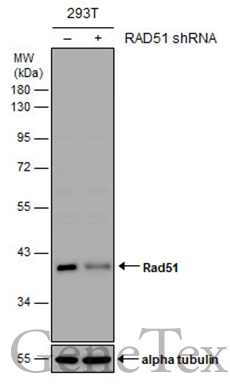 Non-transfected (–) and transfected (+) 293T whole cell extracts (30 μg) were separated by 10% SDS-PAGE, and the membrane was blotted with Rad51 antibody (GTX118249) diluted at 1:1000.