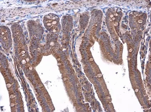 RAB39B antibody detects RAB39B protein at cytoplasm in mouse duodenum by immunohistochemical analysis. Sample: Paraffin-embedded mouse duodenum. RAB39B antibody (GTX118261) diluted at 1:500. 
 Antigen Retrieval: Citrate buffer, pH 6.0, 15 min