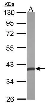 CRYZ antibody [N1C1]