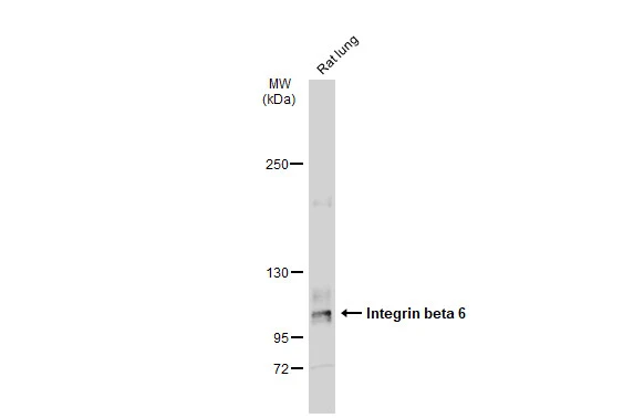 Rat tissue extract (50 μg) was separated by 5% SDS-PAGE, and the membrane was blotted with Integrin beta 6 antibody (GTX118323) diluted at 1:500. The HRP-conjugated anti-rabbit IgG antibody (GTX213110-01) was used to detect the primary antibody.