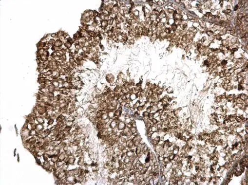 ITGB6 antibody detects ITGB6 protein at membrane and cytosol on mouse testis by immunohistochemical analysis. Sample: Paraffin-embedded mouse testis. ITGB6 antibody (GTX118323) dilution: 1:500. 
 Antigen Retrieval: Trilogy? (EDTA based, pH 8.0) buffer, 15min