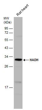 Rat tissue extract (50 μg) was separated by 12% SDS-PAGE, and the membrane was blotted with HADH antibody (GTX118325) diluted at 1:1000. The HRP-conjugated anti-rabbit IgG antibody (GTX213110-01) was used to detect the primary antibody. Rat tissue extract (50 μg) was separated by 12% SDS-PAGE, and the membrane was blotted with HADH antibody (GTX118325) diluted at 1:1000. The HRP-conjugated anti-rabbit IgG antibody (GTX213110-01) was used to detect the primary antibody.
