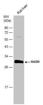 Rat tissue extract (50 μg) was separated by 12% SDS-PAGE, and the membrane was blotted with HADH antibody (GTX118325) diluted at 1:1000. The HRP-conjugated anti-rabbit IgG antibody (GTX213110-01) was used to detect the primary antibody. Rat tissue extract (50 μg) was separated by 12% SDS-PAGE, and the membrane was blotted with HADH antibody (GTX118325) diluted at 1:1000. The HRP-conjugated anti-rabbit IgG antibody (GTX213110-01) was used to detect the primary antibody.