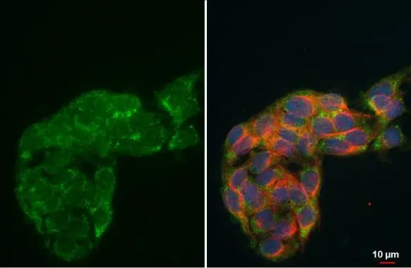 HADH antibody detects HADH protein at mitochondria by immunofluorescent analysis. Sample: HepG2 cells were fixed in 4% paraformaldehyde at RT for 15 min. Green: HADH stained by HADH antibody (GTX118325) diluted at 1:500. Red: alpha Tubulin, a cytoskeleton marker, stained by alpha Tubulin antibody [GT114] (GTX628802) diluted at 1:1000. Blue: Fluoroshield with DAPI (GTX30920).
