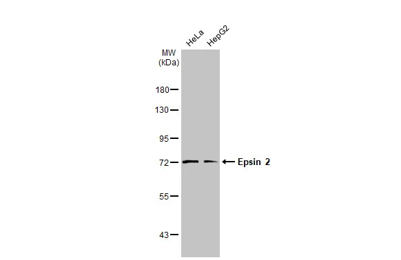 Various whole cell extracts (30 μg) were separated by 7.5% SDS-PAGE, and the membrane was blotted with Epsin 2 antibody [N1C1] (GTX118330) diluted at 1:1000. The HRP-conjugated anti-rabbit IgG antibody (GTX213110-01) was used to detect the primary antibody.