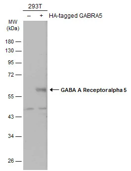 Non-transfected (–) and transfected (+) 293T whole cell extracts (30 μg) were separated by 10% SDS-PAGE, and the membrane was blotted with GABA A Receptor alpha 5 antibody [N2C2], Internal (GTX118345) diluted at 1:500. The HRP-conjugated anti-rabbit IgG antibody (GTX213110-01) was used to detect the primary antibody.
