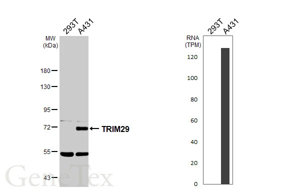 Various whole cell extracts (30 μg) were separated by 7.5% SDS-PAGE, and the membrane was blotted with TRIM29 antibody [N3C3] (GTX118367) diluted at 1:1000. The HRP-conjugated anti-rabbit IgG antibody (GTX213110-01) was used to detect the primary antibody. Corresponding RNA expression data are based on Human Protein Atlas program.