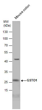 Mouse tissue extract (50 μg) was separated by 12% SDS-PAGE, and the membrane was blotted with GSTO1 antibody (GTX118439) diluted at 1:5000.