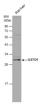 Rat tissue extract (50 μg) was separated by 12% SDS-PAGE, and the membrane was blotted with GSTO1 antibody (GTX118439) diluted at 1:5000.