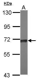 TKTL2 antibody [N1N3]