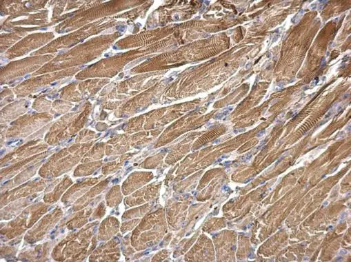 SNX25 antibody [N2C1], Internal detects SNX25 protein at cytosol on mouse muscle by immunohistochemical analysis. Sample: Paraffin-embedded mouse muscle. SNX25 antibody [N2C1], Internal (GTX118491) dilution: 1:500. 
 Antigen Retrieval: Trilogy? (EDTA based, pH 8.0) buffer, 15min