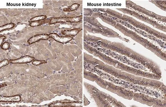 SNX5 antibody [N2C2], Internal