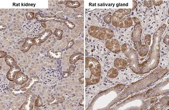 SNX5 antibody [N2C2], Internal