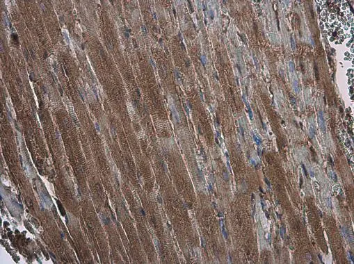 EFHA1 antibody detects EFHA1 protein at cytoplasm in rat heart by immunohistochemical analysis. Sample: Paraffin-embedded rat heart. EFHA1 antibody (GTX118555) diluted at 1:500. 
 Antigen Retrieval: Citrate buffer, pH 6.0, 15 min