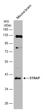 STRAP antibody [N1C3]