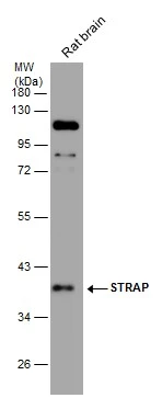 STRAP antibody [N1C3]