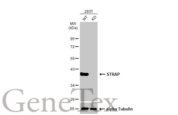 STRAP antibody [N1C3]