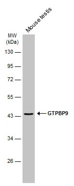 Mouse tissue extract (50 μg) was separated by 10% SDS-PAGE, and the membrane was blotted with GTPBP9 antibody [N1C1] (GTX118604) diluted at 1:1000. The HRP-conjugated anti-rabbit IgG antibody (GTX213110-01) was used to detect the primary antibody.