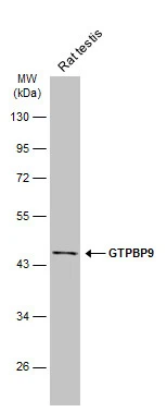 Rat tissue extract (50 μg) was separated by 10% SDS-PAGE, and the membrane was blotted with GTPBP9 antibody [N1C1] (GTX118604) diluted at 1:1000. The HRP-conjugated anti-rabbit IgG antibody (GTX213110-01) was used to detect the primary antibody.