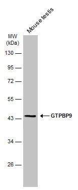 Mouse tissue extract (50 μg) was separated by 10% SDS-PAGE, and the membrane was blotted with GTPBP9 antibody [C1C3] (GTX118605) diluted at 1:1000. The HRP-conjugated anti-rabbit IgG antibody (GTX213110-01) was used to detect the primary antibody.
