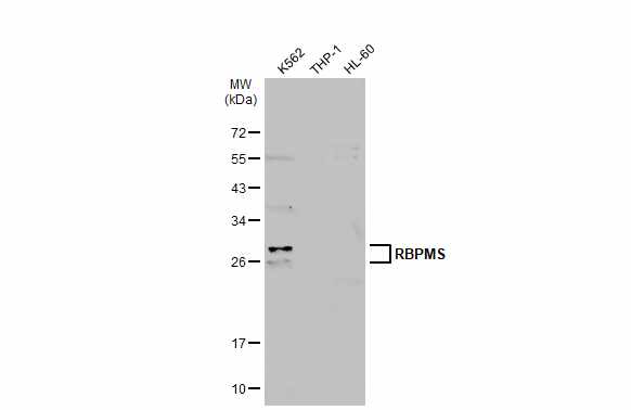 RBPMS antibody detects RBPMS protein at cytoplasm and nucleus by immunohistochemical analysis. Sample: Paraffin-embedded rat colon. RBPMS stained by RBPMS antibody (GTX118619) diluted at 1:500. Antigen Retrieval: Citrate buffer,pH 6.0,15 min