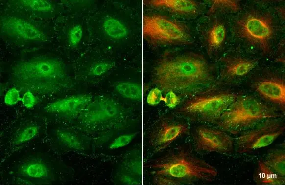 RBPMS antibody detects RBPMS protein at cytoplasm and nucleus by immunofluorescent analysis. Sample: A549 cells were fixed in 4% paraformaldehyde at RT for 15 min. Green: RBPMS stained by RBPMS antibody (GTX118619) diluted at 1:500. Red: alpha Tubulin, a cytoskeleton marker, stained by alpha Tubulin antibody [GT114] (GTX628802) diluted at 1:1000.