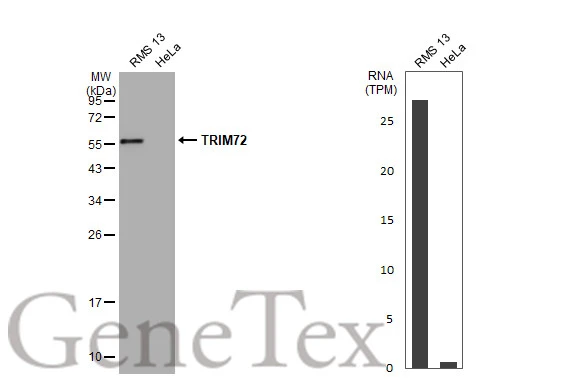 Various whole cell extracts (30 μg) were separated by 12% SDS-PAGE, and the membrane was blotted with TRIM72 antibody (GTX118625) diluted at 1:1000. The HRP-conjugated anti-rabbit IgG antibody (GTX213110-01) was used to detect the primary antibody. Corresponding RNA expression data for the same cell lines are based on Human Protein Atlas program.
