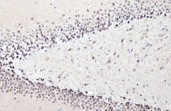 NFIX antibody [N2C2], Internal detects NFIX protein at nucleus by immunohistochemical analysis. Sample: Paraffin-embedded rat hippocampus. NFIX stained by NFIX antibody [N2C2], Internal (GTX118630) diluted at 1:2000. Antigen Retrieval: Citrate buffer, pH 6.0, 15 min