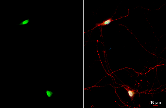 NFIX antibody [N2C2], Internal detects NFIX protein by immunofluorescent analysis. Sample: DIV9 rat hippocampal neuron cells were fixed in 4% paraformaldehyde at RT for 15 min. Green: NFIX stained by NFIX antibody [N2C2], Internal (GTX118630) diluted at 1:500. Red: Tau, an axon marker, stained by Tau antibody [GT287] (GTX634809) diluted at 1:500. Blue: Fluoroshield with DAPI (GTX30920).