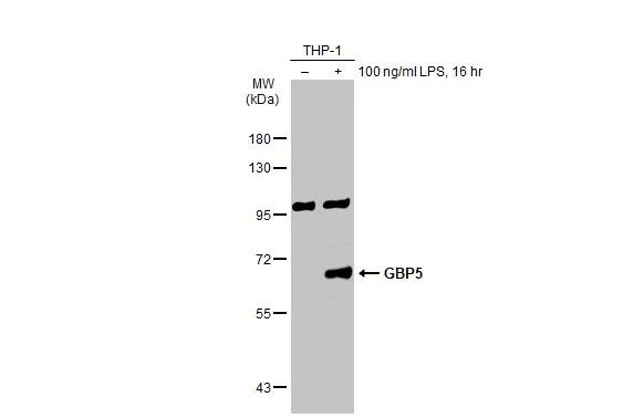 Untreated (–) and treated (+) THP-1 whole cell extracts (30 μg) were separated by 7.5% SDS-PAGE, and the membrane was blotted with GBP5 antibody [N3C3] (GTX118635) diluted at 1:500. The HRP-conjugated anti-rabbit IgG antibody (GTX213110-01) was used to detect the primary antibody, and the signal was developed with Trident ECL plus-Enhanced.