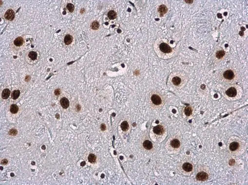 WBP11 antibody detects WBP11 protein at nucleus in rat brain by immunohistochemical analysis. Sample: Paraffin-embedded rat brain. WBP11 antibody (GTX118654) diluted at 1:500. 
 Antigen Retrieval: Citrate buffer, pH 6.0, 15 min