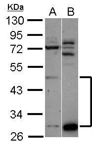 Sample (30 ug of whole cell lysate) A: A549 B: HepG2 10% SDS PAGE GTX118703 diluted at 1:1000 