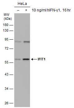 Untreated (–) and treated (+) HeLa whole cell extracts (30 μg) were separated by 10% SDS-PAGE, and the membrane was blotted with IFIT1 antibody [N1C1] (GTX118713) diluted at 1:1000.