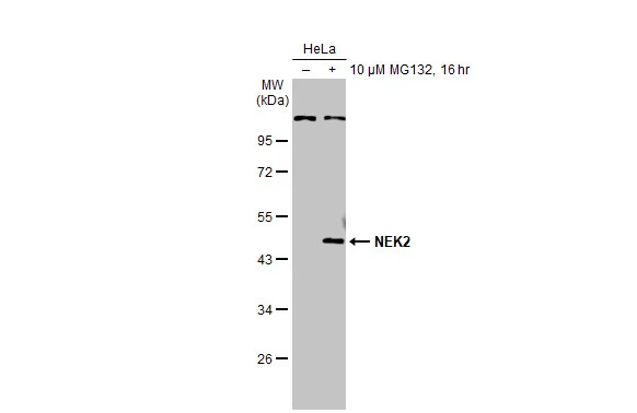 Untreated (–) and treated (+) HeLa whole cell extracts (30 μg) were separated by 10% SDS-PAGE, and the membrane was blotted with NEK2 antibody (GTX118735) diluted at 1:1000. The HRP-conjugated anti-rabbit IgG antibody (GTX213110-01) was used to detect the primary antibody.