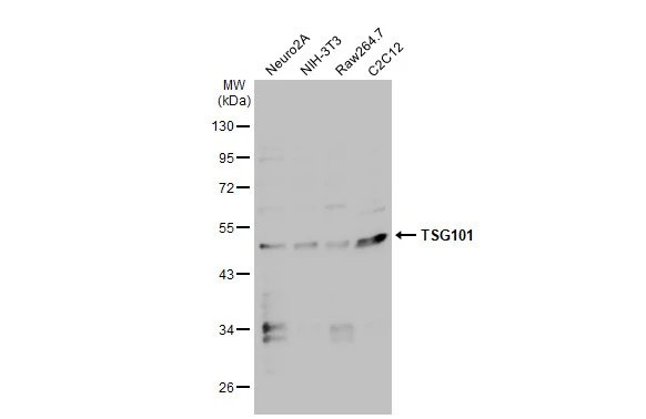 Various whole cell extracts (30 μg) were separated by 10% SDS-PAGE, and the membrane was blotted with TSG101 antibody (GTX118736) diluted at 1:1000. The HRP-conjugated anti-rabbit IgG antibody (GTX213110-01) was used to detect the primary antibody.