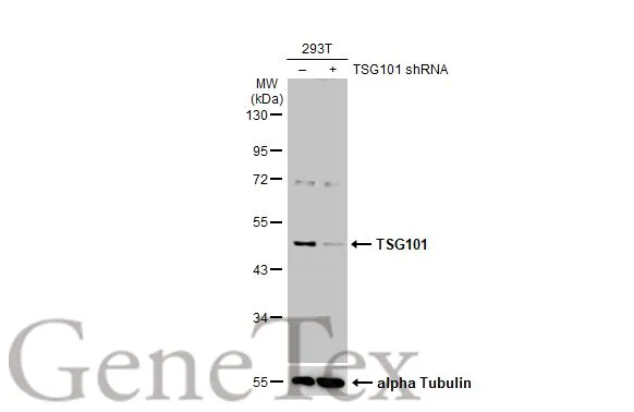 Non-transfected (–) and transfected (+) 293T whole cell extracts (30 μg) were separated by 10% SDS-PAGE, and the membrane was blotted with TSG101 antibody (GTX118736) diluted at 1:500. The HRP-conjugated anti-rabbit IgG antibody (GTX213110-01) was used to detect the primary antibody, and the signal was developed with Trident ECL plus-Enhanced.
