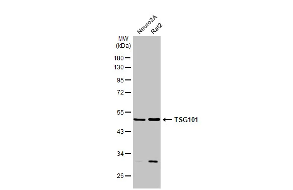 Various whole cell extracts (30 μg) were separated by 10% SDS-PAGE, and the membrane was blotted with TSG101 antibody (GTX118736) diluted at 1:1000. The HRP-conjugated anti-rabbit IgG antibody (GTX213110-01) was used to detect the primary antibody.