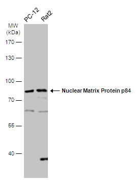 Various whole cell extracts (30 μg) were separated by 7.5% SDS-PAGE, and the membrane was blotted with Nuclear Matrix Protein p84 antibody (GTX118740) diluted at 1:500. The HRP-conjugated anti-rabbit IgG antibody (GTX213110-01) was used to detect the primary antibody.